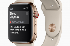 Apple-Watch-Series4_ECG-SinusRhythm_09122018